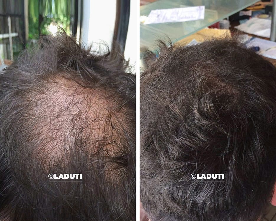 LADUTI Hajszérum Élménykép - Laduti Experience 01