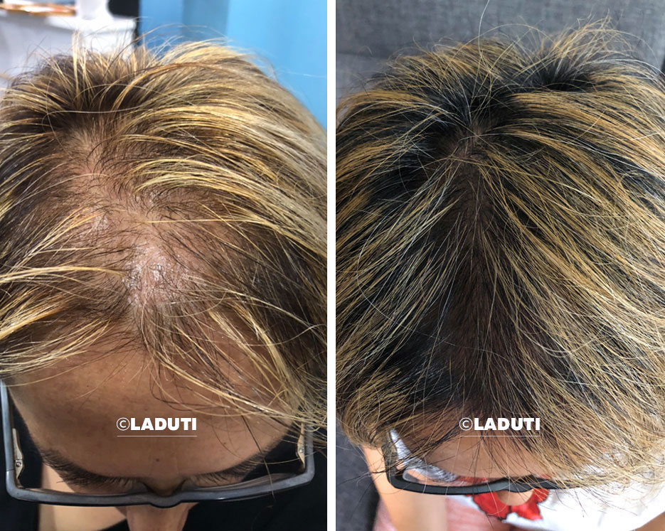 LADUTI Hajszérum Élménykép - Laduti Experience 02