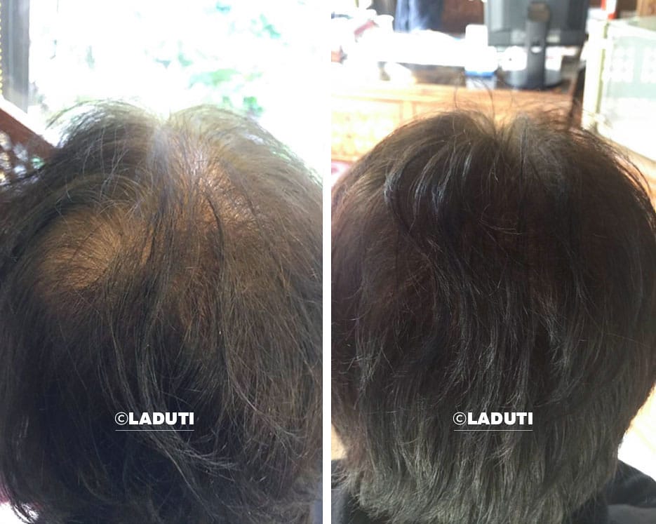 LADUTI Hajszérum Élménykép - Laduti Experience 05
