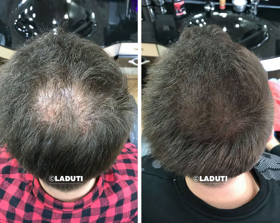 LADUTI Hajszérum Élménykép - Laduti Experience 06